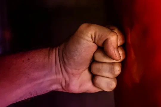 TÍPICAS LESIONES DE BOXEADORES EN LAS MANOS